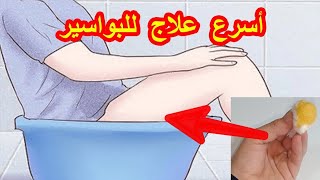 أقسم بالله دهنة واحدة علاج نهائي البواسير الداخليةوالخارجية والناسور الشرجى من أول استعمال بدون علاج