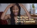 Traction Alopecia Can Affect Anyone | Pretty Shouldn't Hurt