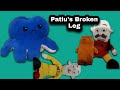 DemonsKingChannel Movie : Patlu&#39;s Broken Leg! - DemonsKingChannel