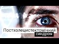 Постхолецистектомічний синдром: агресія жовчі. Губергріц Н.Б