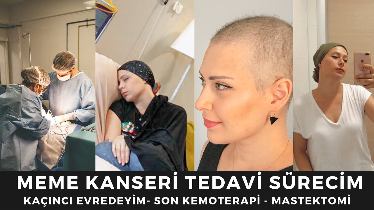 Meme Kanseri Tedavi Sürecim Hakkında | Büyük Ameliyat Öncesi Son Video