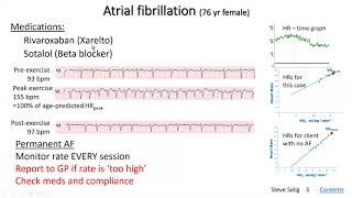 atrial fibrillation and exercise: part 3: case study