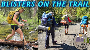 How To Deal With Blisters On The Trail & How To Prevent Them