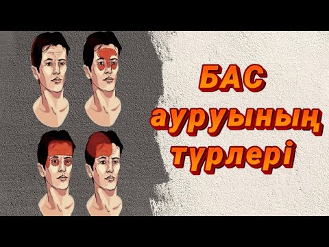 Бейне: Мигрени үшін невропатологқа баруым керек пе?