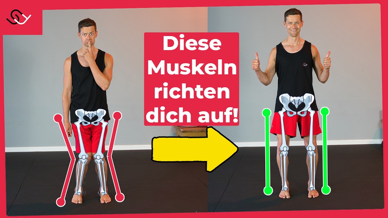 X-Beine loswerden - Mit diesen 2 Übungen