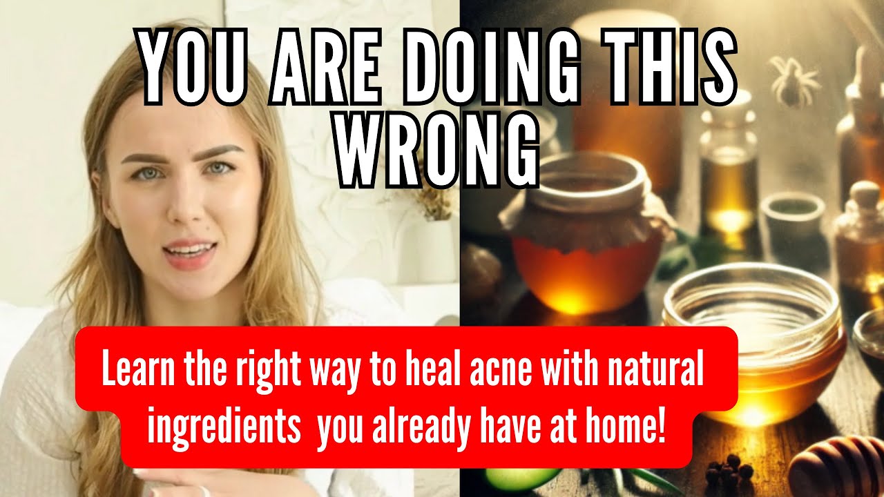 How to Heal Acne Naturally with Ingredients You Have at Home! 🍯💧 - YouTube