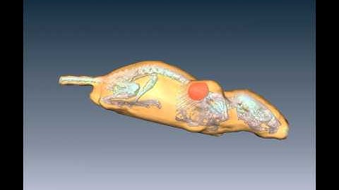 MicroCT tumor segmentation with level sets