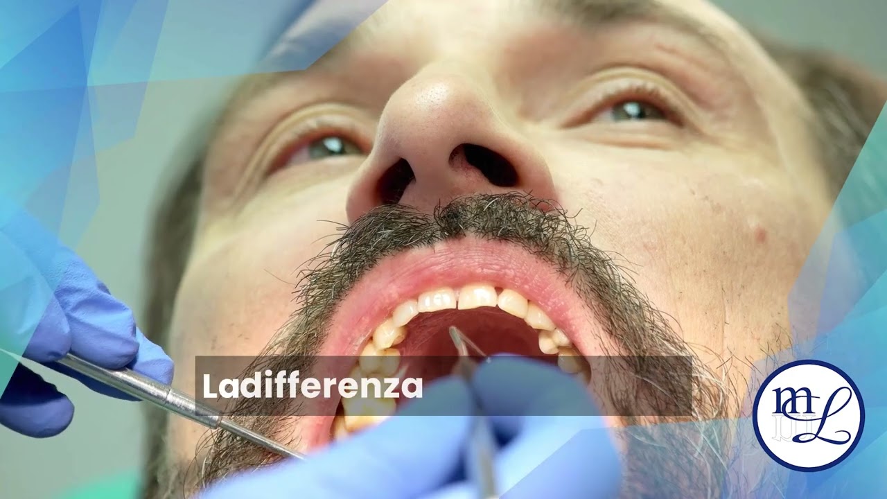 Parodontologia: La salute delle tue gengive