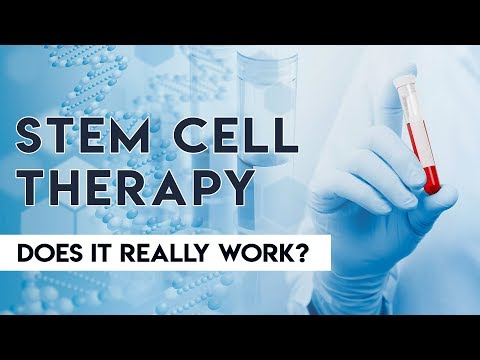 Does Stem Cell Therapy Work?