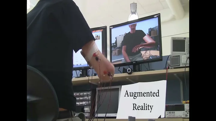 Phantom limb pain (PLP) treatment based in VR, AR, gaming, and MPR