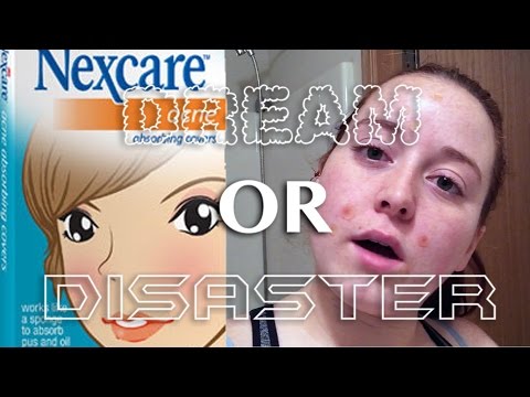 NEXCARE ACNE COVERS ~ DREAM OR DISASTER!