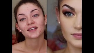 Covering Acne Makeup Tutorial