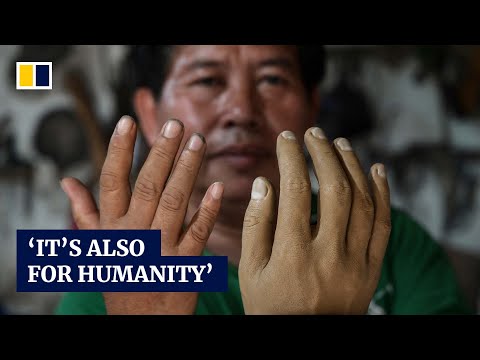 Indonesian leprosy survivor sculpts artificial limbs to try and help villagers with the illness