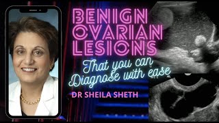 BENIGN OVARIAN LESIONS THAT YOU CAN DIAGNOSE WITH EASE || DR SHEILA SHETH || SONOBUZZ REWIND screenshot 5