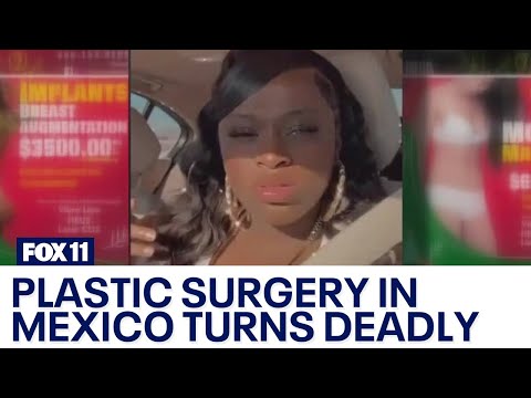 LA woman dies during plastic surgery in Mexico