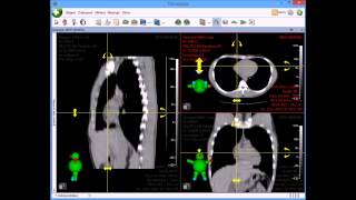 Dicompass 3 - MPR