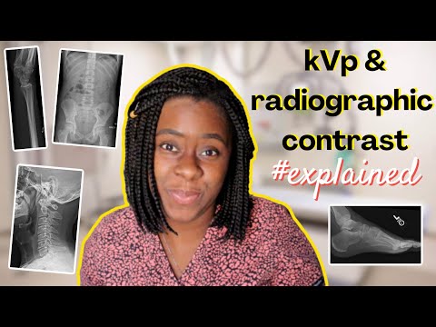 kVp & radiographic contrast explained || Ask The Rad Tech