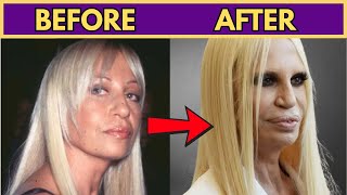 60 SHOCKING STAR TRANSFORMATIONS: THE DARK SIDE OF COSMETIC SURGERY
