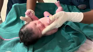 Newborn Baby's First Moments After Birth 👶❤️ Miracle of Life #shorts#fyp#newborn#baby #cute#trending