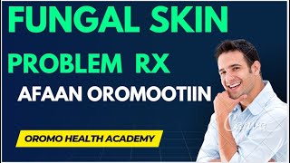 SALPHUMATTI FUNGAL SKIN INFECTION WALLANUUF AFAAN OROMOOTIIN screenshot 1