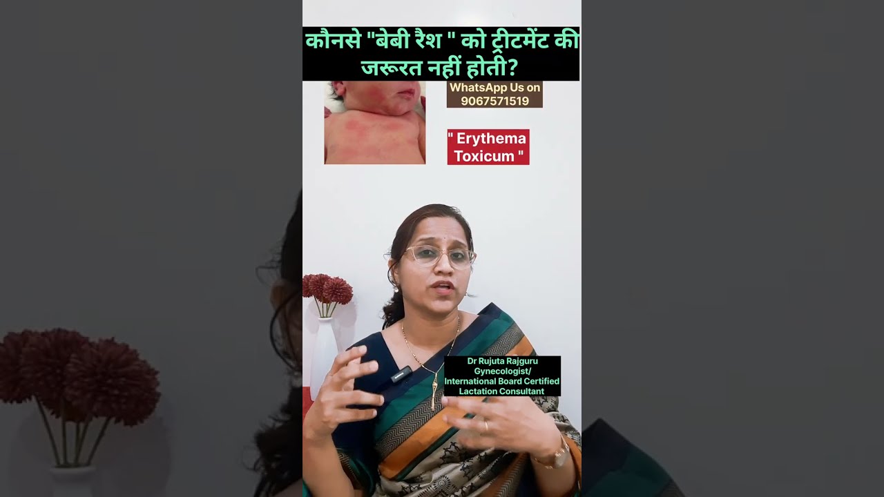 Newborn Baby rashes- Erythema Toxicum,Milia, explained.नवजात शिशू की त्वचा पर लाल चकत्ते, सफेद दाणे