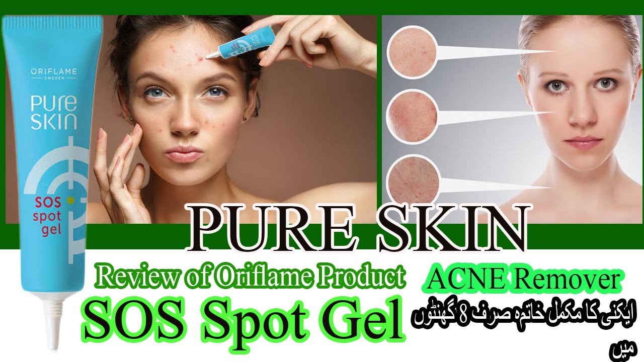 oriflame acne spot treatment