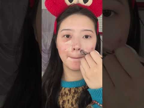 크리스마스 기념 여드름 지우는 법