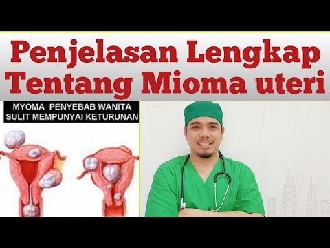 Video: Apa itu leiomioma rahim subserosa?