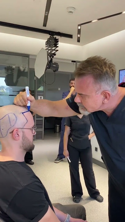 Here is a before surgery process video! #hairtransplant #asmed #korayerdogan