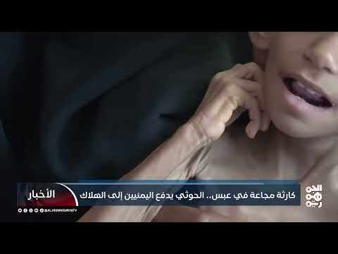 عبس في اليمن: مجاعة تهدد آلاف الأطفال وتفاقم الأزمة الإنسانية