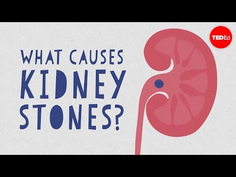 Thumbnail for the embedded element "What causes kidney stones? - Arash Shadman"