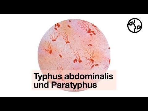 Video: Ist Typhus Ansteckend? Was Du Wissen Musst