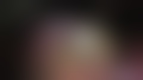 Extreme Liver Surgery: Extended left hepatectomy with ante-situm perfusion and vena cava replacement