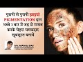 पुरानी से पुरानी झाइयां PIGMENTATION धब्बे 1 बार में जड़ से गायब चेहरा चमकदार बनायें DR. MANOJ DAS