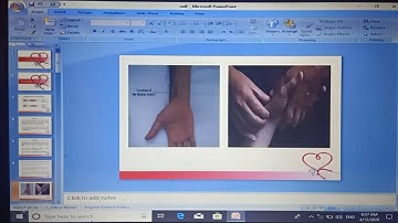 CVS Examination (Pulse) Power point Dr Mohamed Fayez