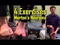 4 Exercises for Mortons Neuroma | Exercises to AVOID Surgery | How To Heal Mortons Neuroma Quickly