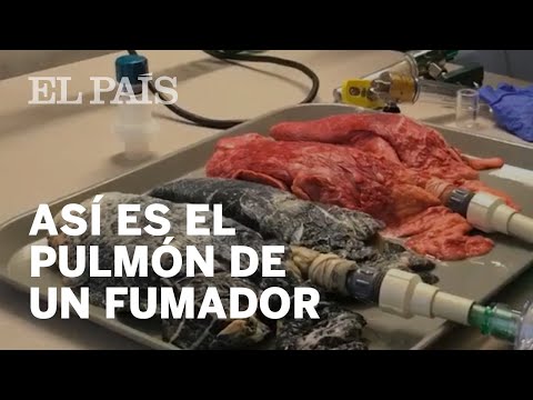 Video: ¿A los fumadores ocasionales les da cáncer?