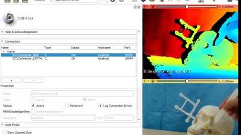 Real-time depth and image data in 3D Slicer