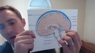Can Multiple Sclerosis be caused by head and neck trauma?