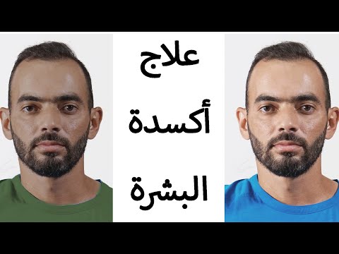 فيديو: ما هو عكس الخدود؟