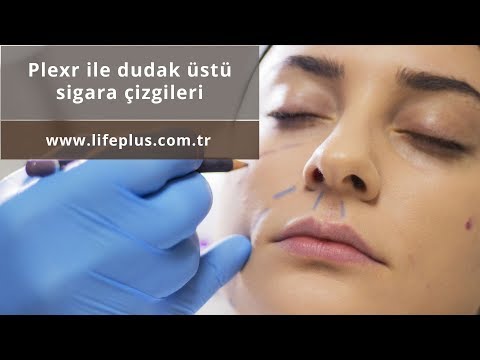 Plexr Ile Dudak üstü Sigara çizgileri Giderilebilir Mi? - Ahmet Karaçam