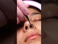 Satisfying Blackhead Cluster Cleanse 🧡