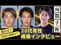 顔が長い!コンプレックスを解消したくて両顎手術を受けた20代男性【術後8ヶ月①】