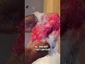 Can African net sponge help with acne?👀 #africansponge #acneskincare #exfoliationtips #glowingskin