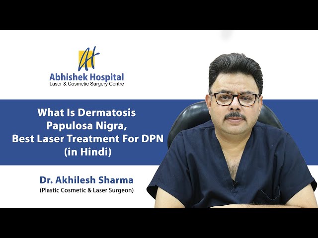 What Is Dermatosis Papulosa Nigra, Best Laser Treatment For DPN (In Hindi)