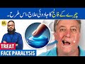 Munh Ka Lakwa Ka Ilaj Herbal Treatment For Facial Paralysis Falij Dr Ibrahim