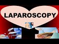 Laparoscopy  indications contraindications procedure post operative care and complications