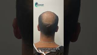 Expert beauty clinic | Plastic Surgery  Hair Tranplant