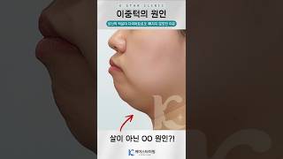 [케이스타의원]  이중턱의 원인별 제거 방법 #kbeautytips #광주 #이중턱 #리프팅 #얼굴지흡 #보톡스 #침샘보톡스