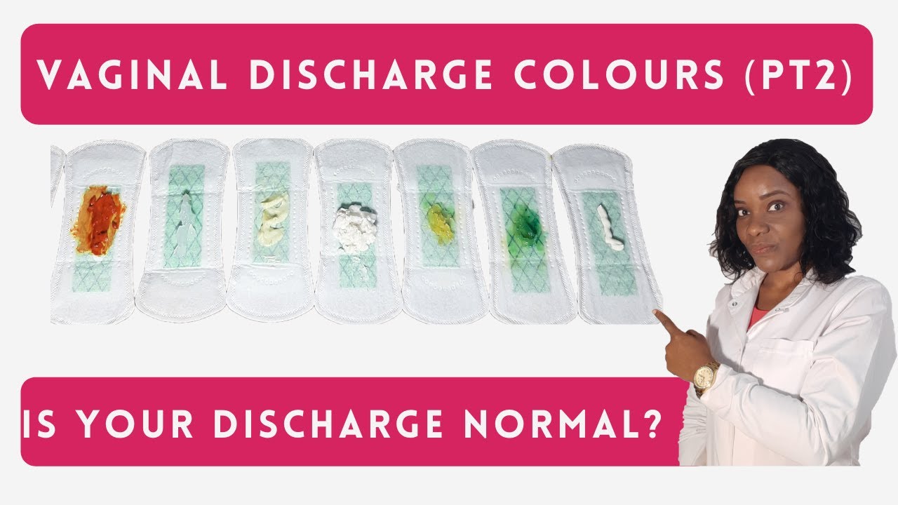 Vaginal Discharge Colours, Normal Vs Abnormal Discharge